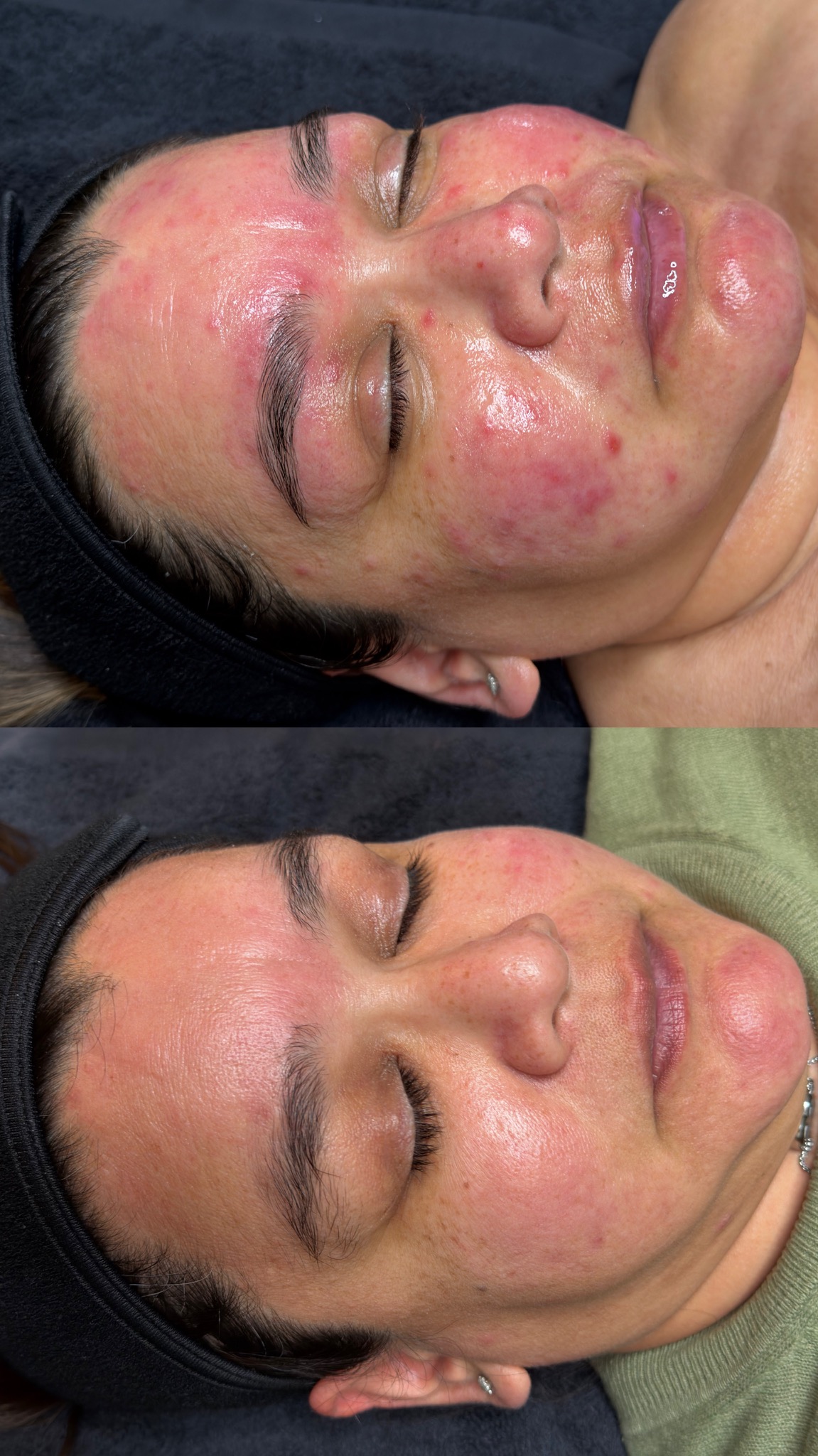 Skin progress with a signature facial and homecare routine curated by Sara
