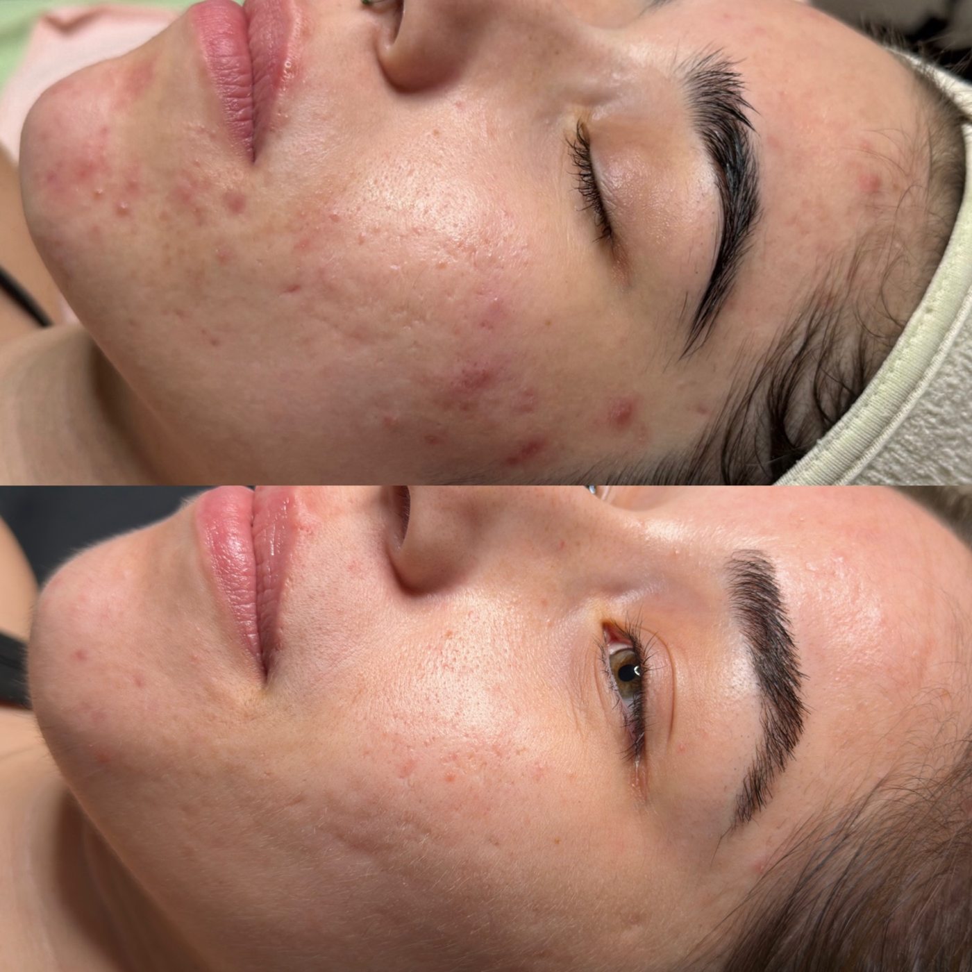 Skin at Etched and Elegant